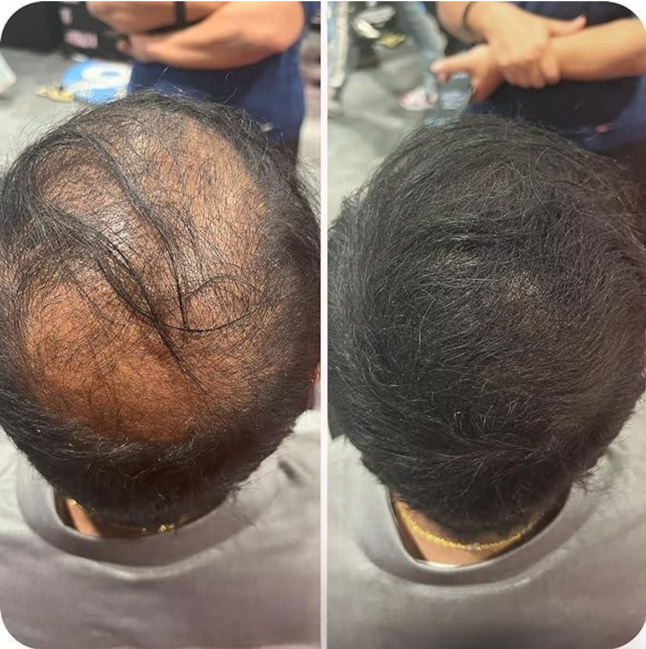 HairMark