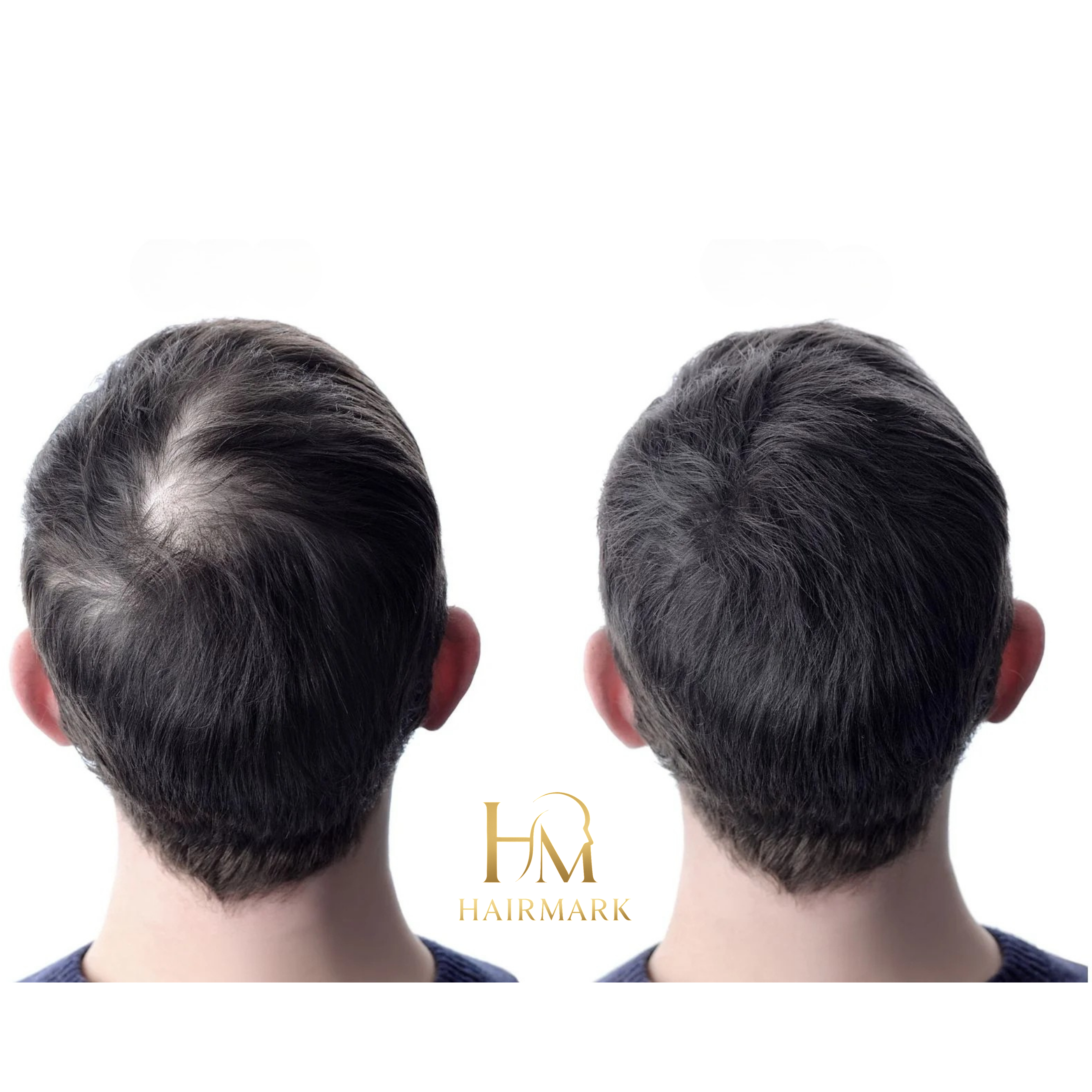 HairMark