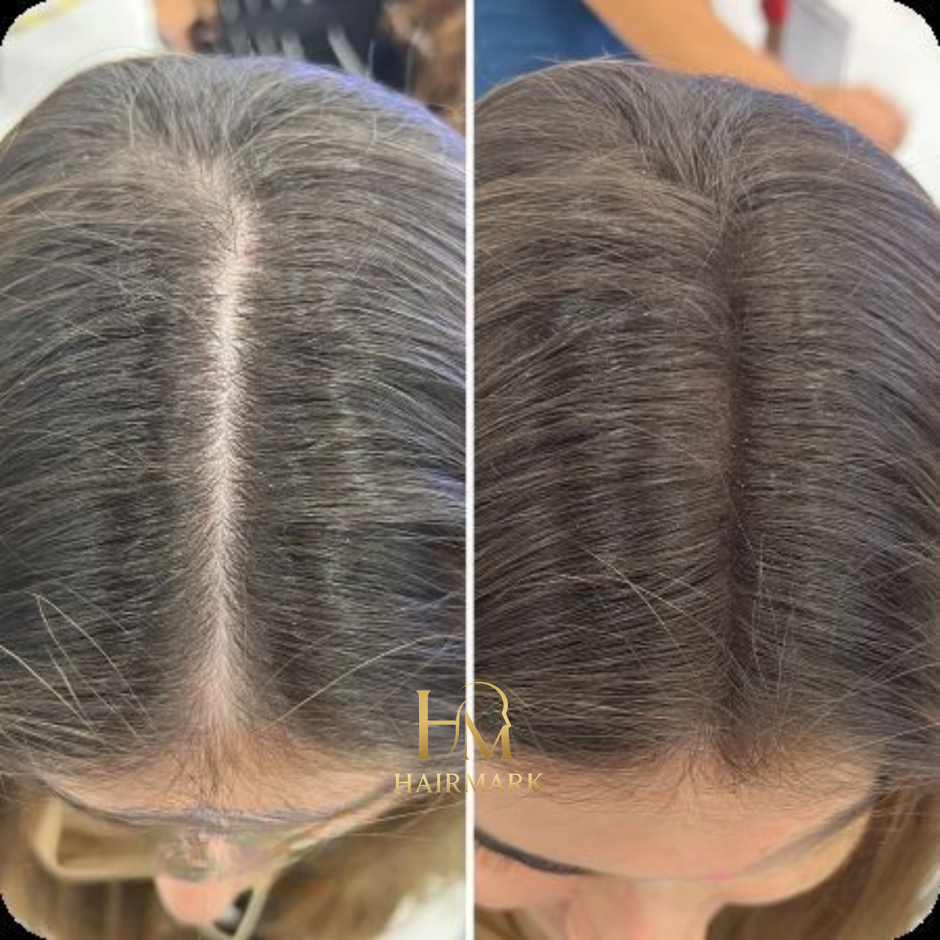 HairMark