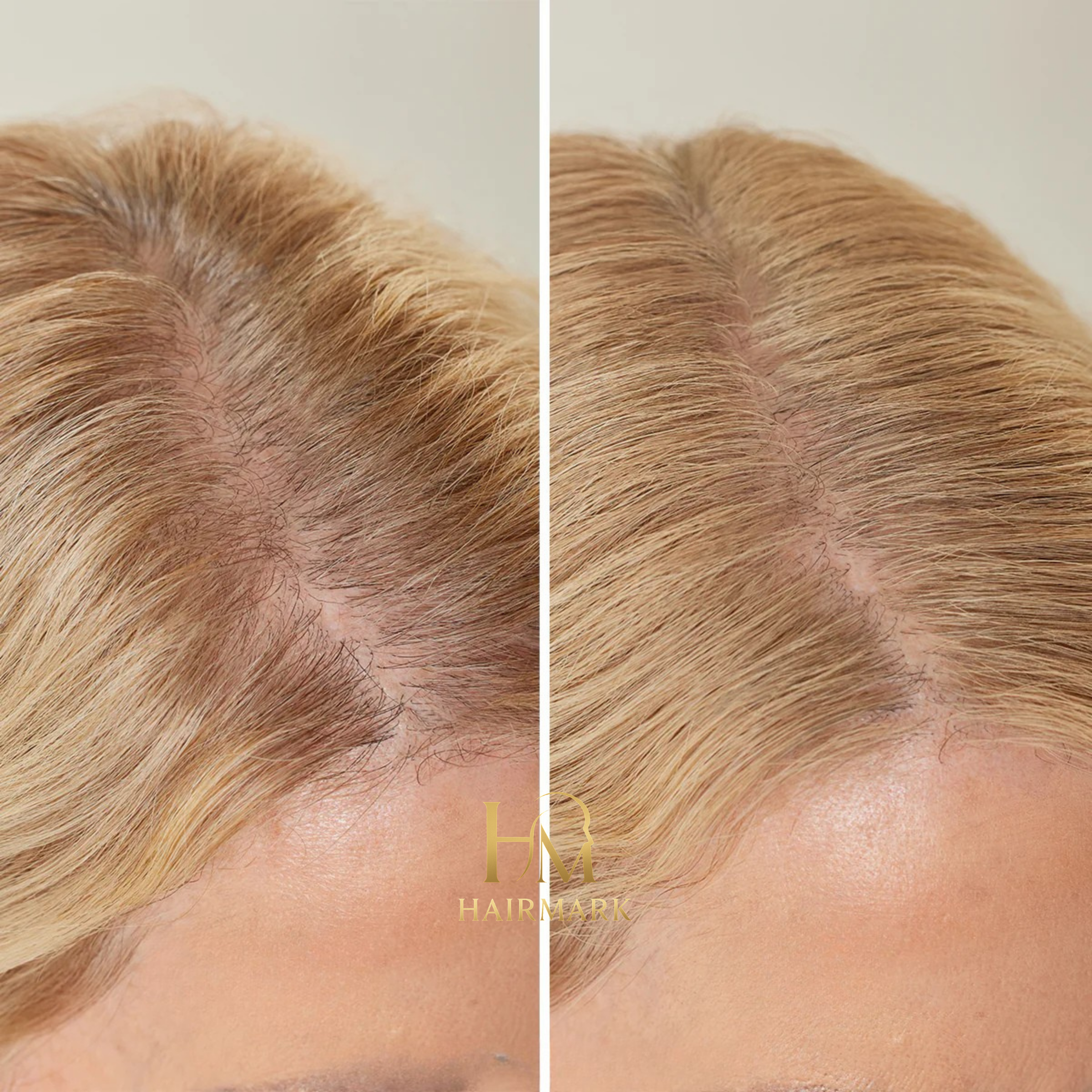 HairMark